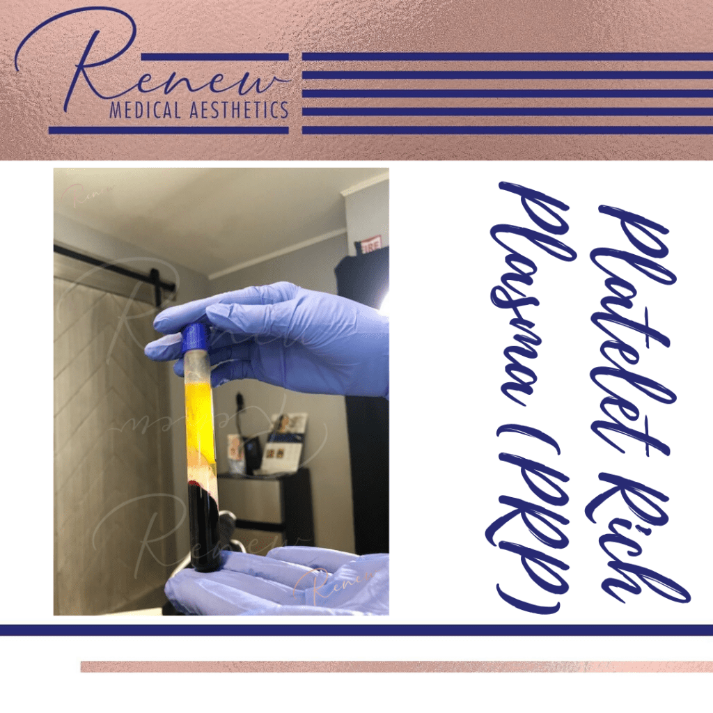 PRP CANVA