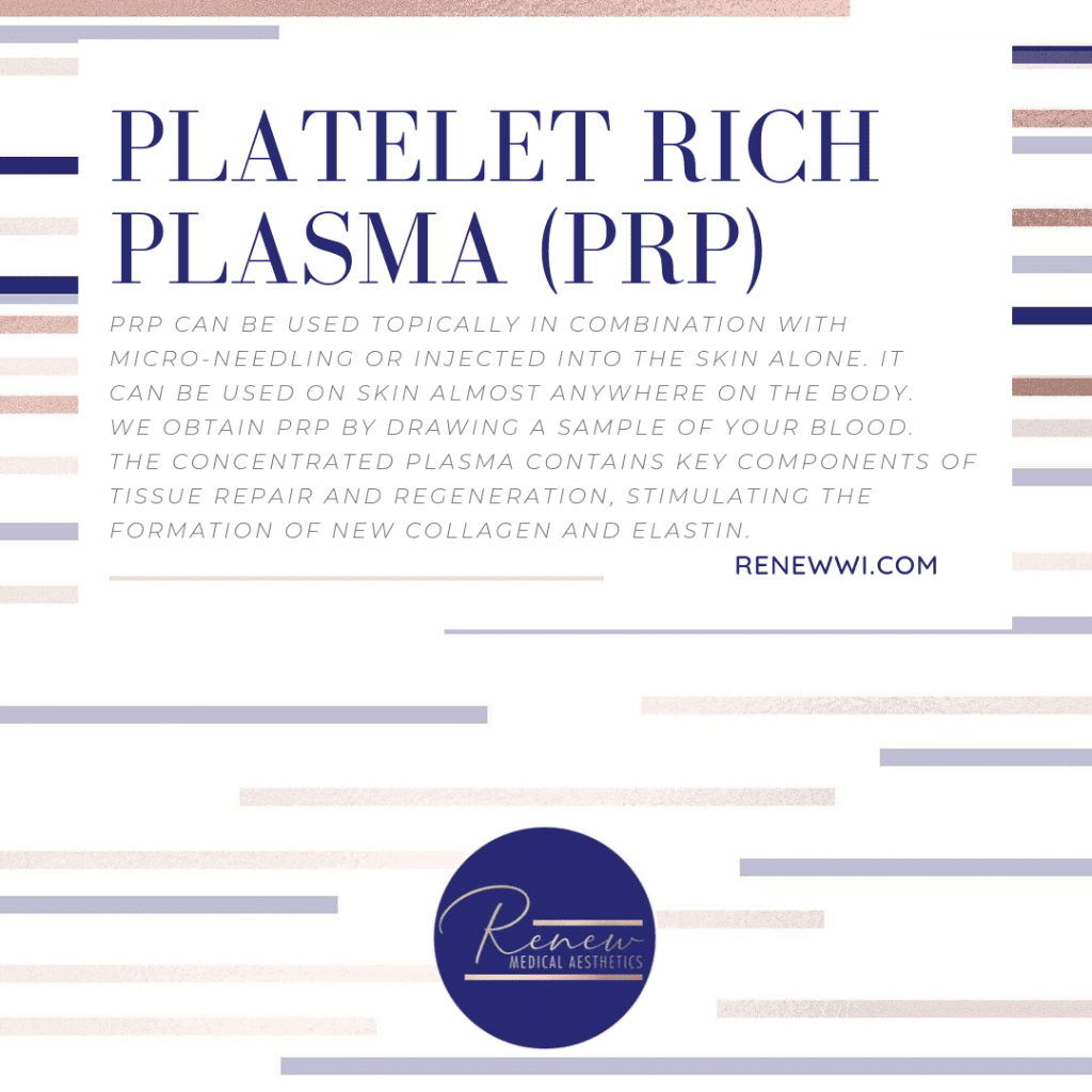 PRP service image
