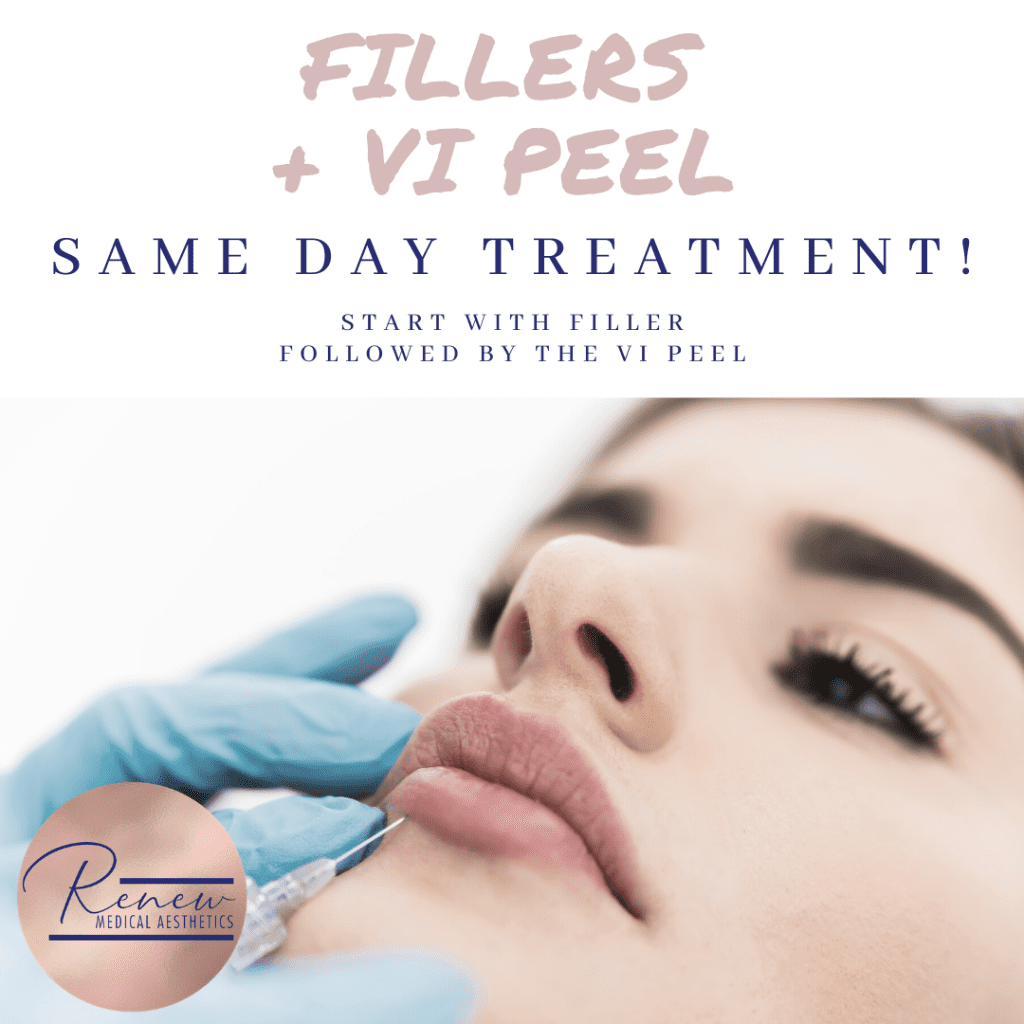 VI Peel filler