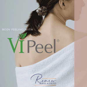 back peel