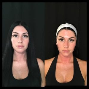 DermaSweep