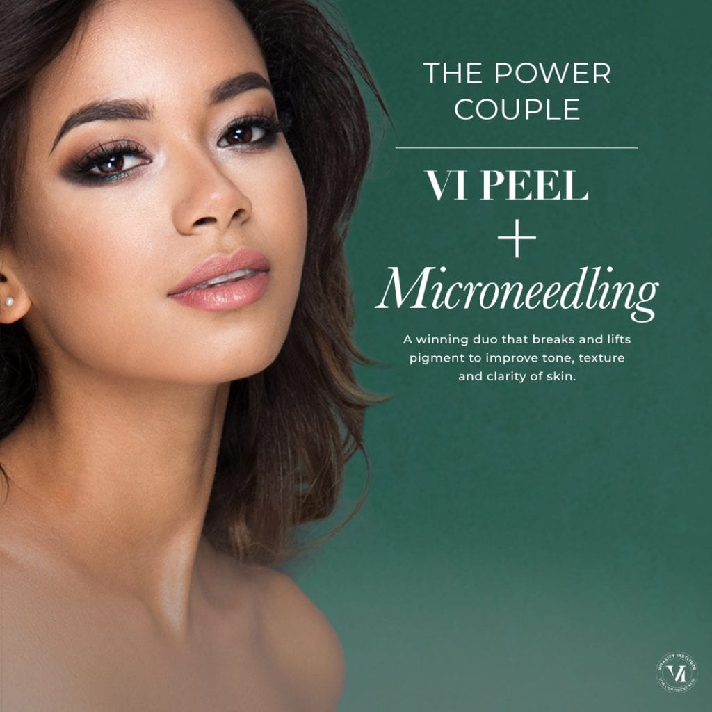 VI Peel+Microneedling