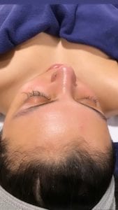 Facial glowing skin