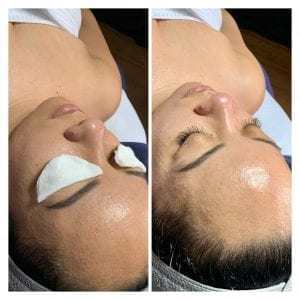 premium facial