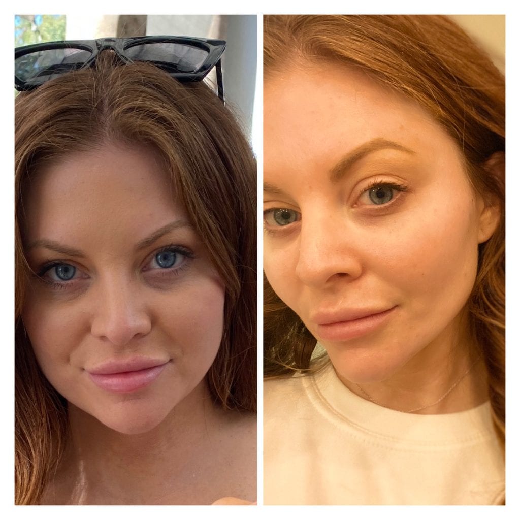 before and after